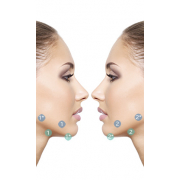 Аппарат миостимуляции ЭСМА 12.16C УНИВЕРСАЛ